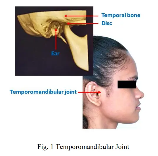Temporomandibular Joint (TMJ) Physiotherapy, TMJ treatment
